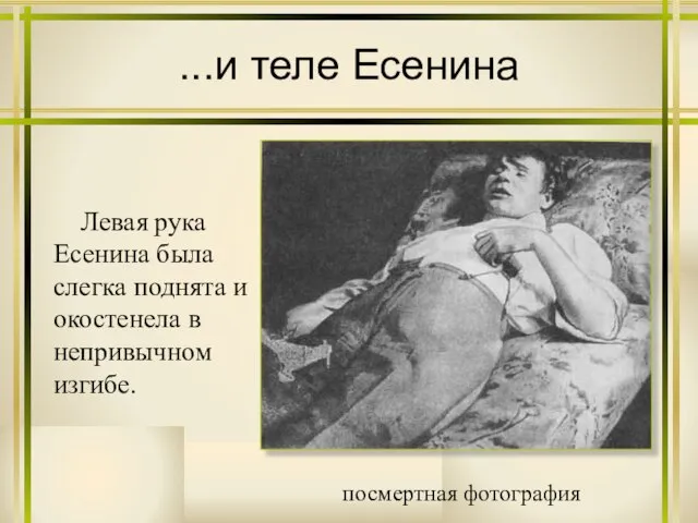 ...и теле Есенина посмертная фотография Левая рука Есенина была слегка поднята и окостенела в непривычном изгибе.