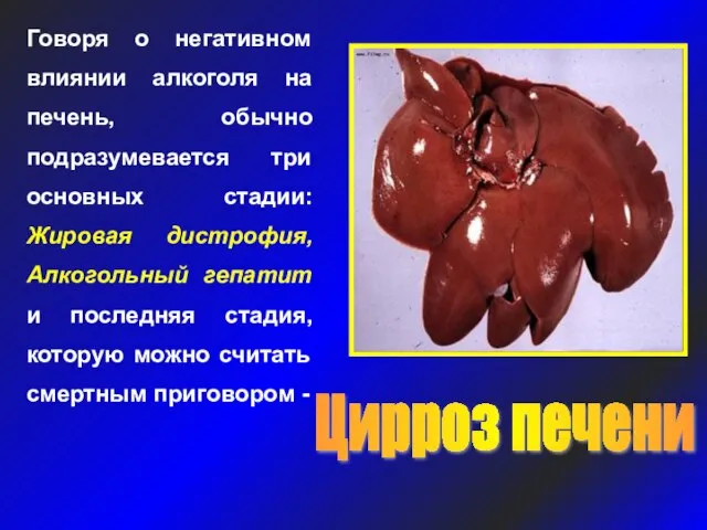 Говоря о негативном влиянии алкоголя на печень, обычно подразумевается три основных стадии: