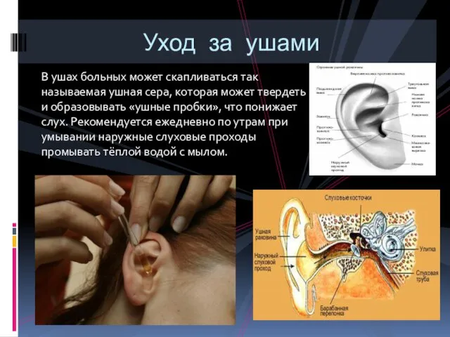 В ушах больных может скапливаться так называемая ушная сера, которая может твердеть