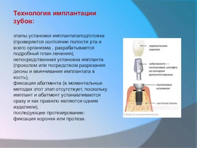 Технология имплантации зубов: этапы установки имплантатаподготовка (проверяется состояние полости рта и всего