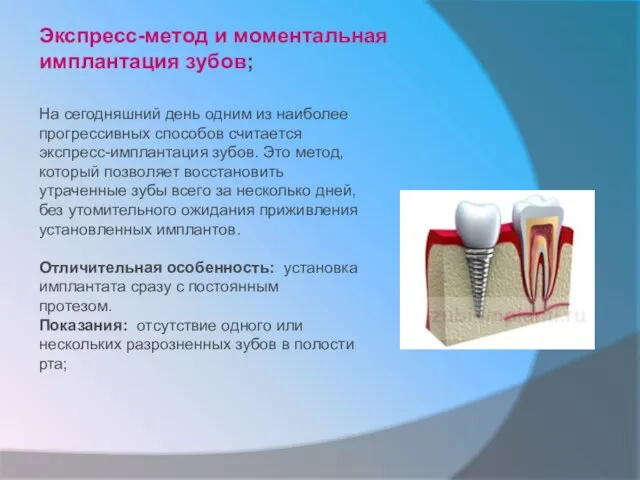 Экспресс-метод и моментальная имплантация зубов; На сегодняшний день одним из наиболее прогрессивных