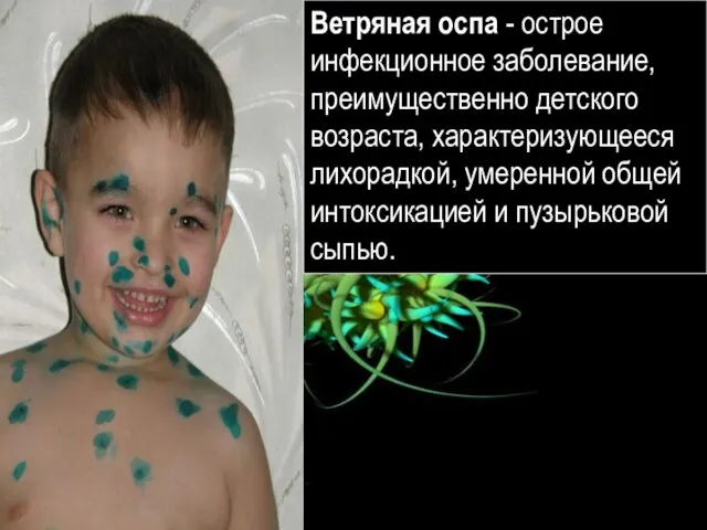 Ребёнок, болеющий ветряной оспой Ветряная оспа - острое инфекционное заболевание, преимущественно детского
