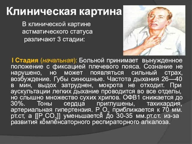 Клиническая картина I Стадия (начальная): Больной принимает вынужденное положение с фиксацией плечевого