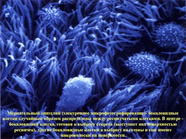 Мерцательный эпителий (электронное микрофотографирование)- бокаловидные клетки случайным образом распределены между реснитчатыми клетками.