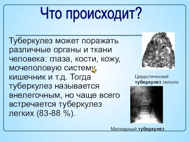 Туберкулез может поражать различные органы и ткани человека: глаза, кости, кожу, мочеполовую