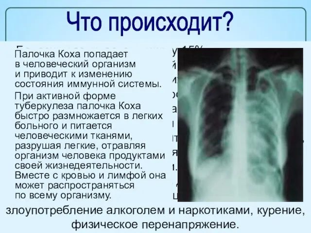 Болезнь развивается лишь у 15% процентов лиц, заразившихся микобактерией туберкулеза. Главной причиной