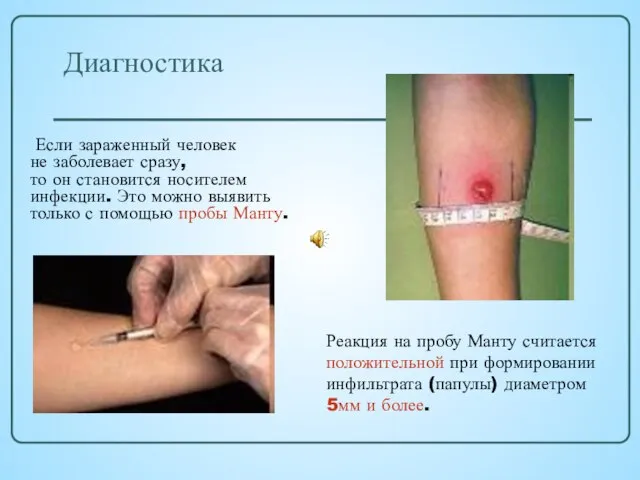 Диагностика Если зараженный человек не заболевает сразу, то он становится носителем инфекции.