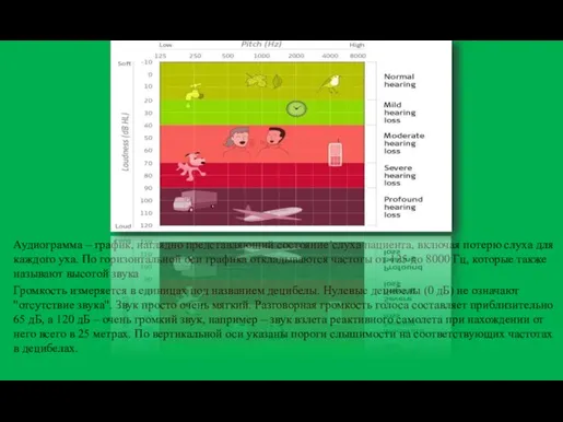 Аудиограмма – график, наглядно представляющий состояние’слуха пациента, включая потерю слуха для каждого