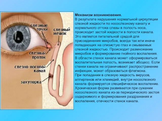 Механизм возникновения. В результате нарушения нормальной циркуляции слезной жидкости по носослезному каналу