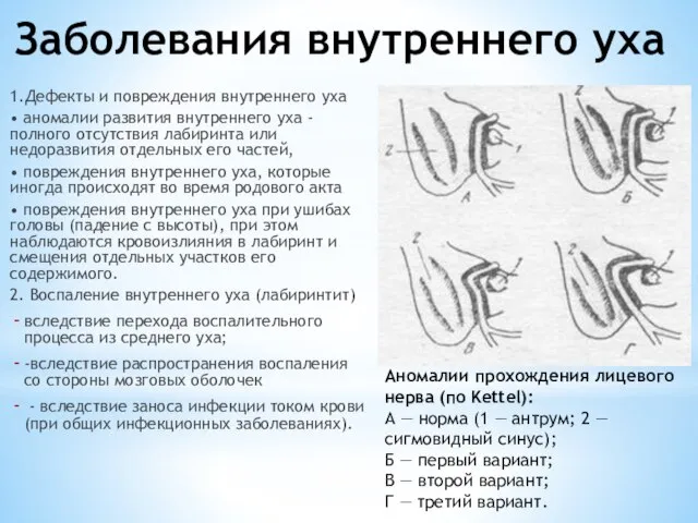 Заболевания внутреннего уха 1.Дефекты и повреждения внутреннего уха • аномалии развития внутреннего