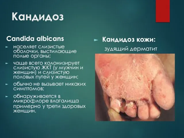 Кандидоз Candida albicans населяет слизистые оболочки, выстилающие полые органы; чаще всего колонизирует