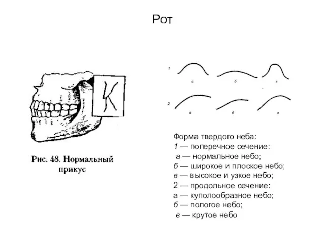 Рот Твердое небо Форма твердого неба: 1 — поперечное сечение: а —