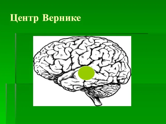 Центр Вернике