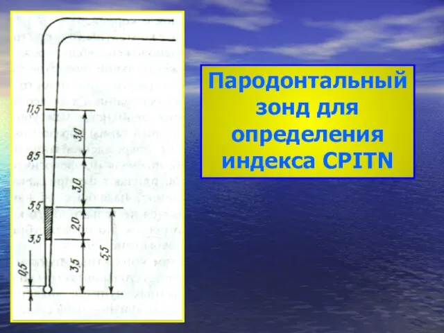 Пародонтальный зонд для определения индекса CPITN