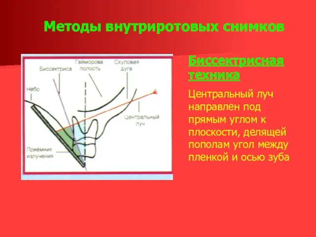 Методы внутриротовых снимков Биссектрисная техника Центральный луч направлен под прямым углом к