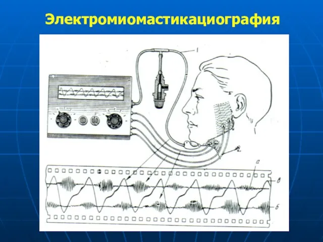 Электромиомастикациография