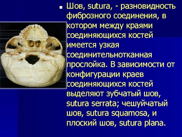 Шов, sutura, - разновидность фиброзного соединения, в котором между краями соединяющихся костей