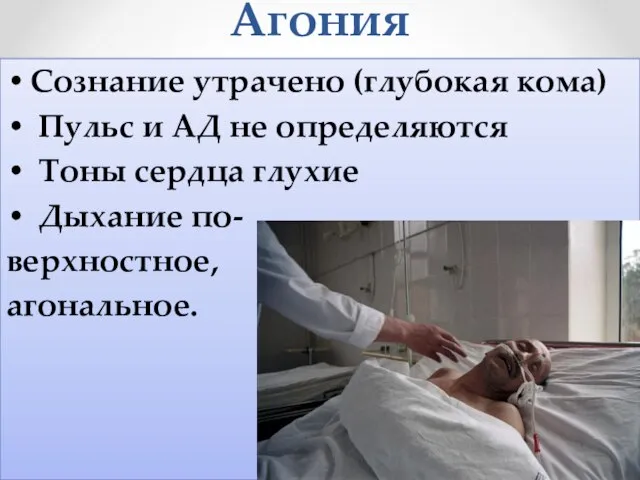 Агония Сознание утрачено (глубокая кома) Пульс и АД не определяются Тоны сердца