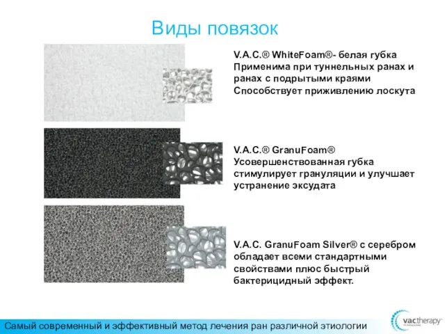 Виды повязок V.A.C.® WhiteFoam®- белая губка Применима при туннельных ранах и ранах