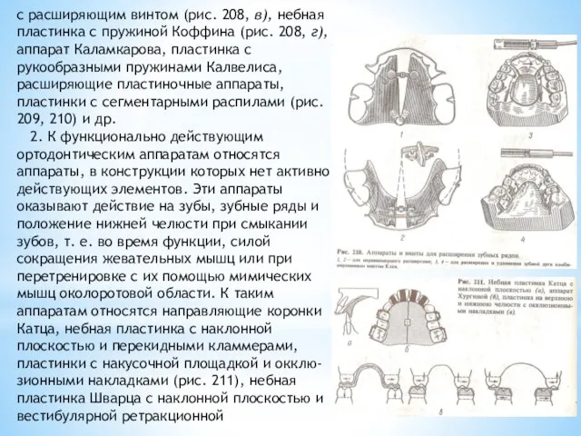 с расширяющим винтом (рис. 208, в), небная пластинка с пружиной Коффина (рис.