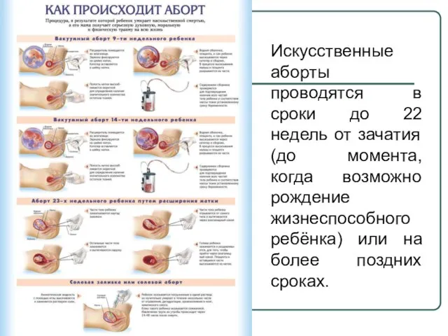 Искусственные аборты проводятся в сроки до 22 недель от зачатия (до момента,