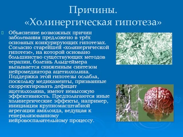 Причины. «Холинергическая гипотеза» Объяснение возможных причин заболевания предложено в трёх основных конкурирующих