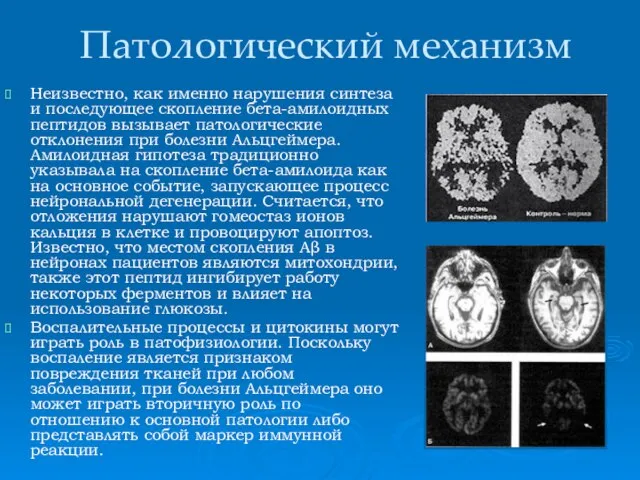 Патологический механизм Неизвестно, как именно нарушения синтеза и последующее скопление бета-амилоидных пептидов