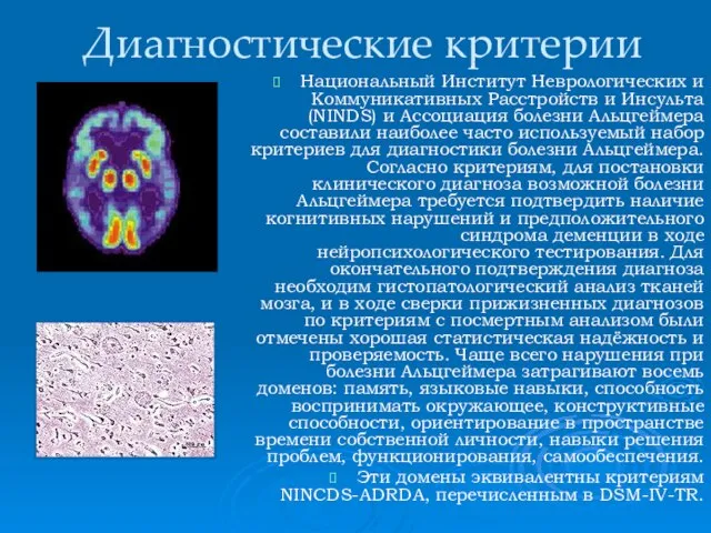 Диагностические критерии Национальный Институт Неврологических и Коммуникативных Расстройств и Инсульта (NINDS) и