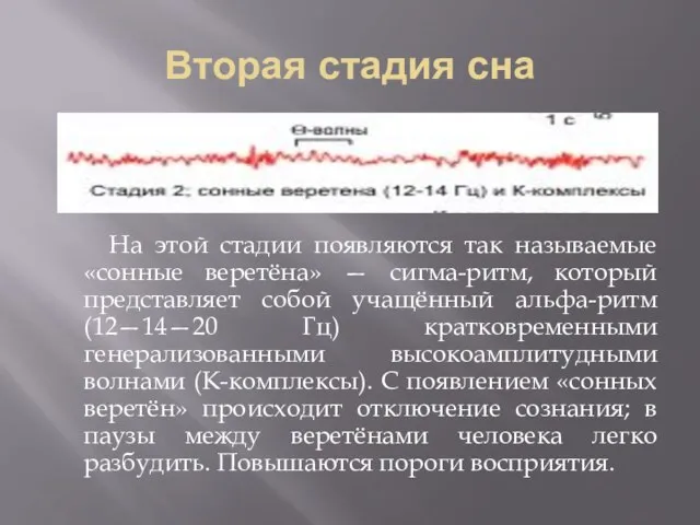 Вторая стадия сна На этой стадии появляются так называемые «сонные веретёна» —