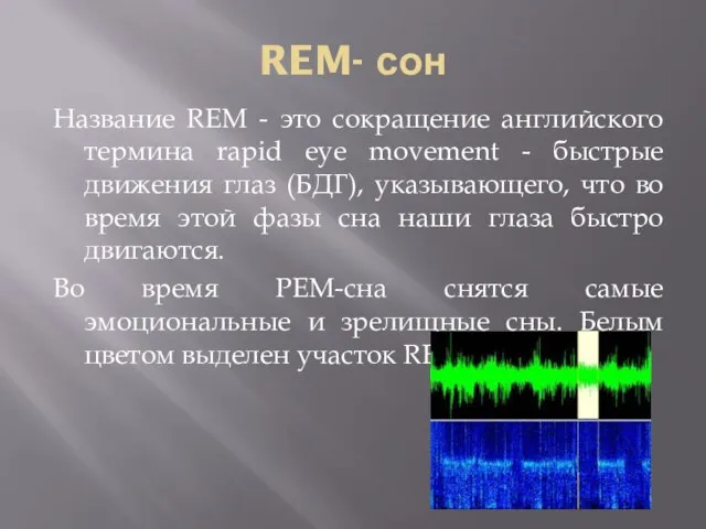 REM- сон Название REM - это сокращение английского термина rapid eye movement