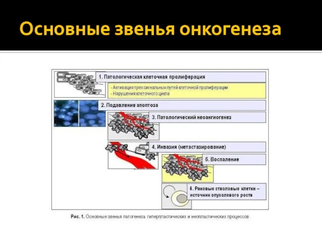 Основные звенья онкогенеза