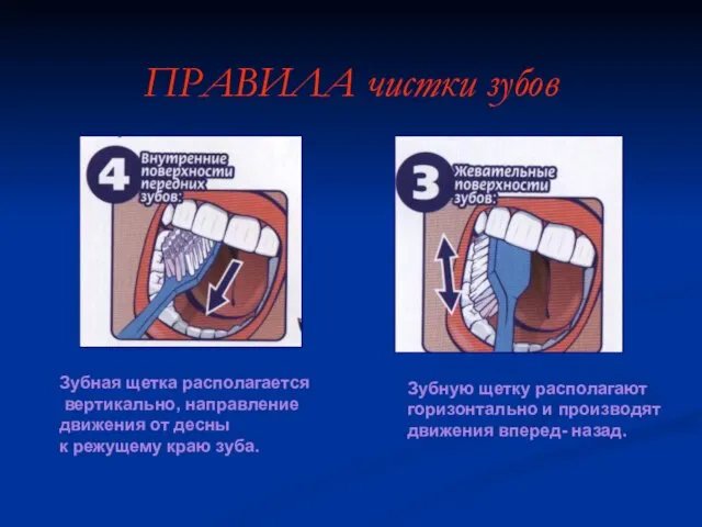 Зубная щетка располагается вертикально, направление движения от десны к режущему краю зуба.