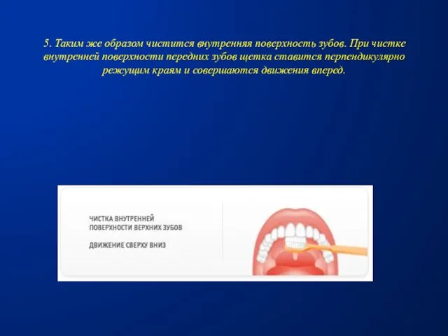 5. Таким же образом чистится внутренняя поверхность зубов. При чистке внутренней поверхности