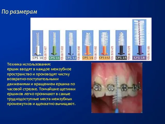 По размерам Техника использования: ершик вводят в каждое межзубное пространство и производят