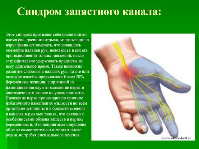 Синдром запястного канала: Этот синдром проявляет себя после или во время сна,