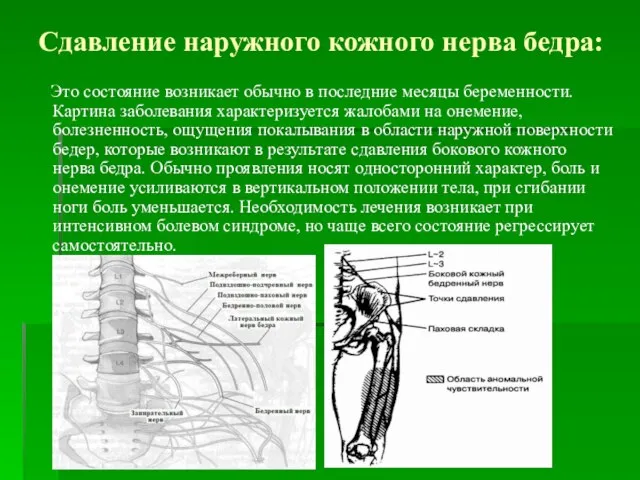 Сдавление наружного кожного нерва бедра: Это состояние возникает обычно в последние месяцы