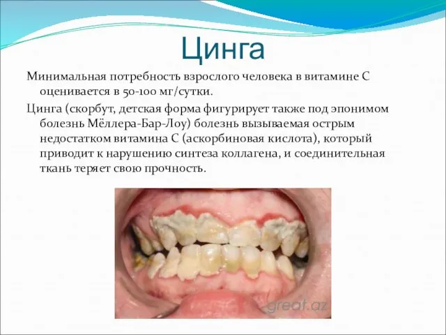 Цинга Минимальная потребность взрослого человека в витамине С оценивается в 50-100 мг/сутки.