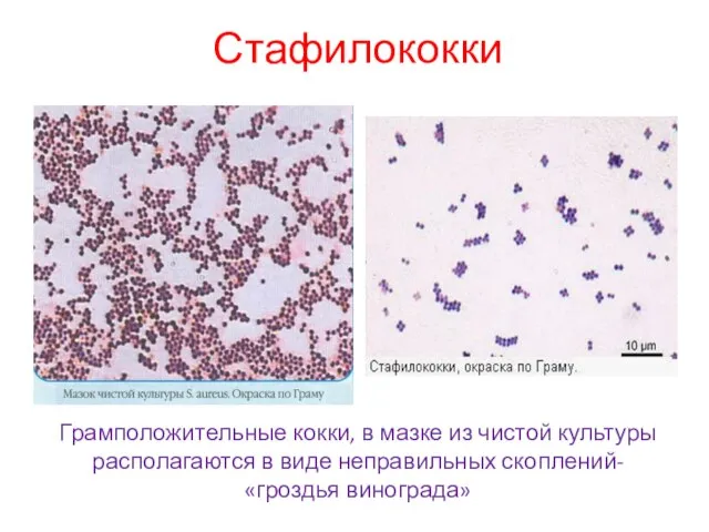 Грамположительные кокки, в мазке из чистой культуры располагаются в виде неправильных скоплений- «гроздья винограда» Стафилококки