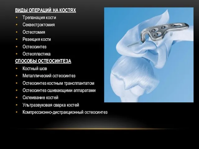 ВИДЫ ОПЕРАЦИЙ НА КОСТЯХ Трепанация кости Секвестрэктомия Остеотомия Резекция кости Остеосинтез Остеопластика