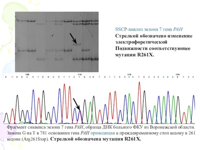 . Фрагмент сиквенса экзона 7 гена РАН, образца ДНК больного ФКУ из