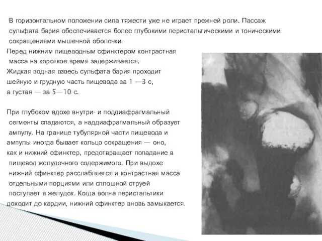 В горизонтальном положении сила тяжести уже не играет прежней роли. Пассаж сульфата