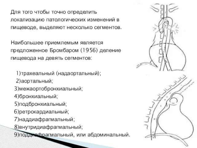 Для того чтобы точно определить локализацию патологических изменений в пищеводе, выделяют несколько