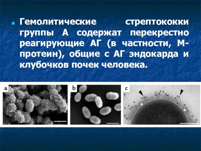 Гемолитические стрептококки группы А содержат перекрестно реагирующие АГ (в частности, М-протеин), общие