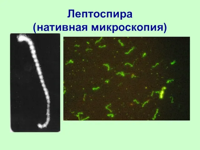 Лептоспира (нативная микроскопия)