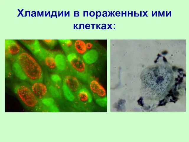 Хламидии в пораженных ими клетках: