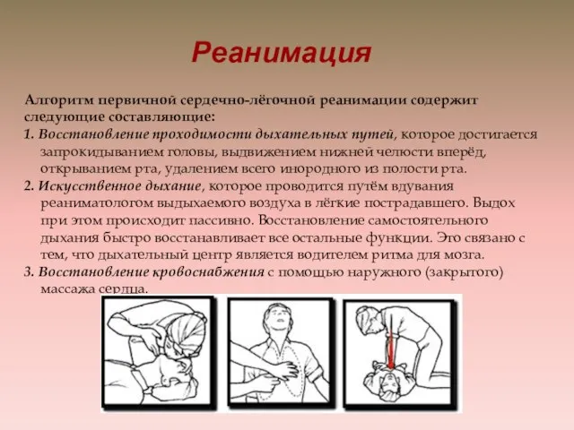 Реанимация Алгоритм первичной сердечно-лёгочной реанимации содержит следующие составляющие: 1. Восстановление проходимости дыхательных