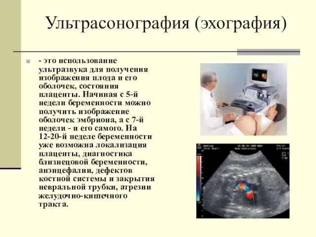 Ультрасонография (эхография) - это использование ультразвука для получения изображения плода и его