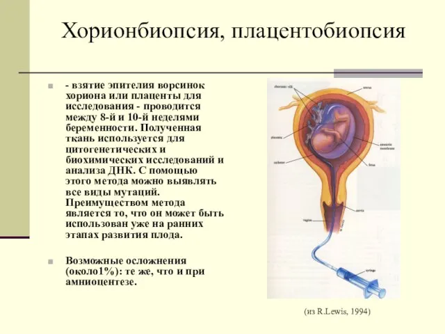 Хорионбиопсия, плацентобиопсия - взятие эпителия ворсинок хориона или плаценты для исследования -