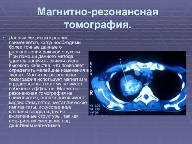 Магнитно-резонансная томография. Данный вид исследования применяется, когда необходимы более точные данные о