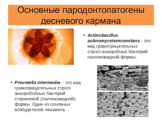 Основные пародонтопатогены десневого кармана Actinobacillus actinomycetemcomitans - это вид грамотрицательных строго анаэробных